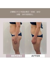 コンバートビューティーオタイ(ConBert Beauty otai)/1回で結果出し