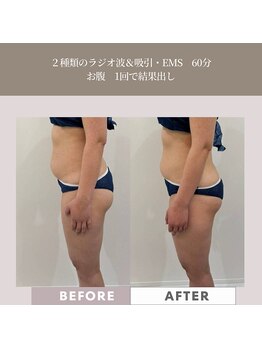 コンバートビューティーオタイ(ConBert Beauty otai)/1回で結果出し