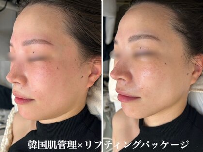 イロハ(IROHA)の写真