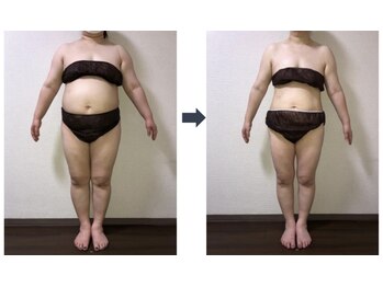 ラディアンス/40代　ビフォーアフター