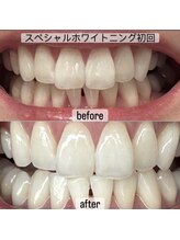 ヤット 森ノ宮(yatto.)/40代女性