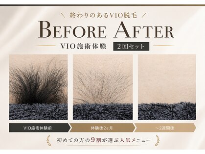 アンジュ(ange)の写真