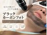 【毛穴/ニキビケア】ブラックカーボンフォトケア¥11000→