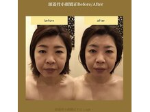 アジール 新潟市(agir)/Before/After画像