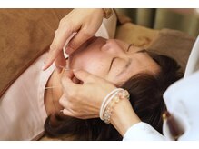 吉宗指圧治療院/美容鍼　刺鍼