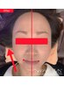 【ＯＰＥＮ記念】たるみ改善・小顔リフトUP！施術後から即実感マッサージ付♪