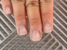 メロー(Meloo)/Step2【角質たくさん取れます】