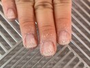 Step2【角質たくさん取れます】