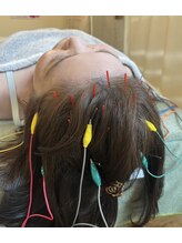 久心宝鍼灸院/とにかく頭鍼