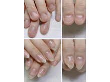 ネイルフレーバー(Nail Fravor)