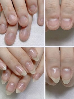 ネイルフレーバー(Nail Fravor)の写真/【健康美な指先に◎】深爪や噛み爪でお悩みの方にオススメ！深爪矯正コースで自信の持てる指先を叶えます♪
