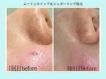 エクラニーク(Eclanique)の雰囲気（ムートンホイップ＋シュガーリング脱毛もオススメ★☆）