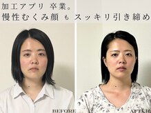 ミラ 長崎駅前店(MIRA)/長崎市_小顔矯正_小顔