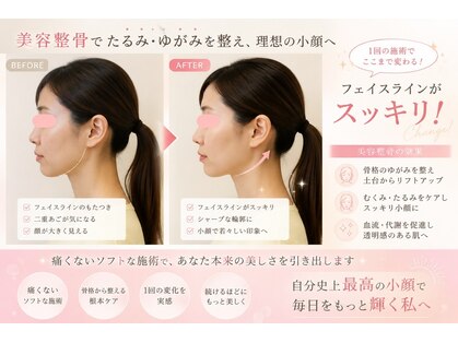 ローズ ド ナチュール(Rose de Nature)の写真