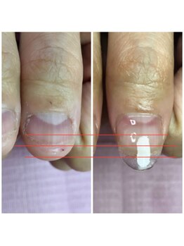 イリスネイル(IRIS NAIL)/