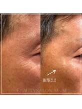 エムアンドエム(M&M)/