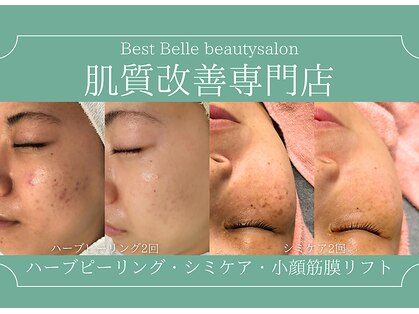 ベストベル(BestBelle)の写真