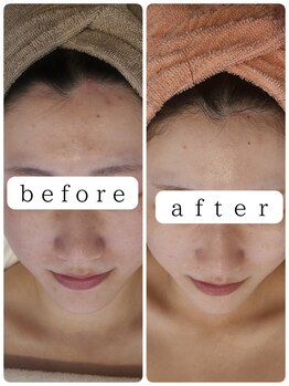 サロンド シェリー(Salon de Cherie)/ハーブピーリング