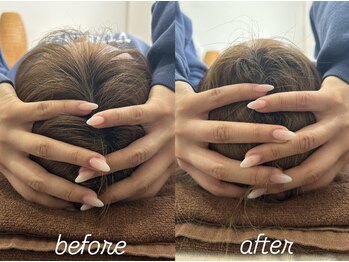 おひさま整骨院 整体院 姫路店/B＆A【姫路/小顔矯正/整体】