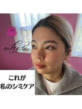 フー(Who?)/これが私のシミケア