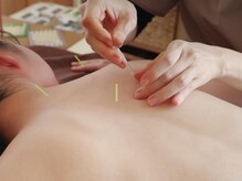 ベストハンズ鍼灸整体院