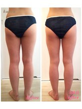 カウラ(Kaura)/下半身ビフォーアフター(肥後橋)