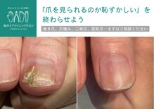 地爪ケアクリニックサロン 刈谷店【5月18日OPEN(予定)】