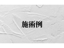 ドクターネイル爪革命 富山店/施術例