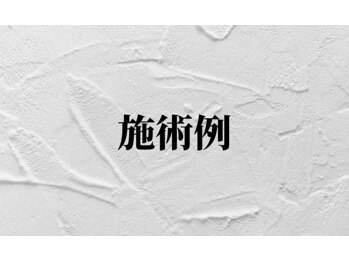 ドクターネイル爪革命 富山店/施術例