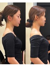 ハリエール 東京中央区(Hari aile)/出張ブライダル美容整体