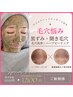 《毛穴》嬉!毛穴洗浄付き☆肌質改善ハーブピーリング(首肩ケア付)16500→