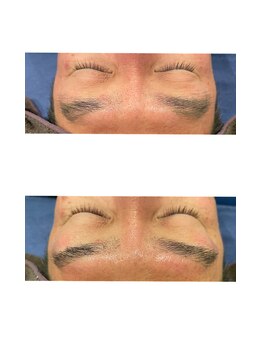 プールオム(Pour Homme)/眉毛脱毛