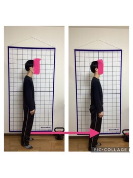 かなえ整体 武蔵新城駅前店/姿勢改善ビフォーアフター