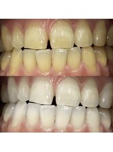 プロテア 藤枝店(PROTEA)/医療提携サロン.ホワイトニング