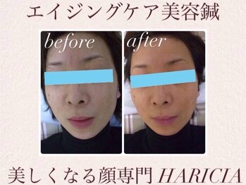 ハリシア(HARICIA)/くすみ、肌トーンの改善