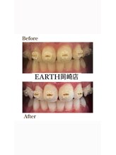 アース 岡崎店(EARTH)/純白なドレス負けない白い歯で!!