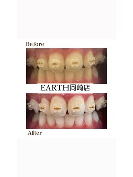 アース 岡崎店(EARTH)/純白なドレス負けない白い歯で!!