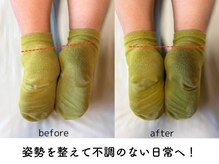 姿勢を整えて頭痛、肩こり、腰痛など不調を根本改善！