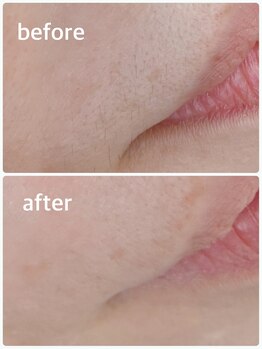 メイクマジック(Makemagic)/お口周りのうぶ毛