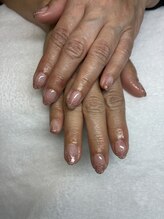 オランダエステティック(Holland Esthetics)/グラデーション