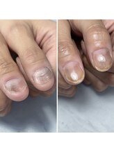 シフォンネイル(Shifon.nail_)