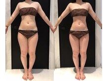 リボディ 表参道(An re Body)/before→after