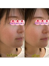 ピエール ナリタイラボ(Piel NARITAI LABO)/小顔整体