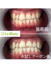 ルブラン 奈良店(Le Blanc)/ご紹介特典！