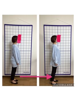 かなえ整体 武蔵新城駅前店/姿勢改善ビフォーアフター