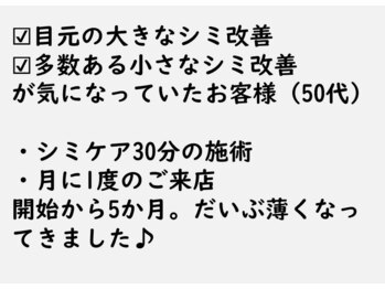 ニコ アンド キャンディー(Nico.&Candy)/本気でシミのお悩みの方へ☆