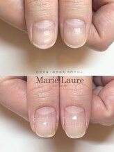 マリーロール 淀屋橋本店(Marie Laure)/自爪育成/深爪矯正/ネイルケア