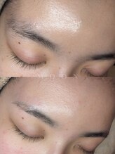 ムーン 横浜(MOON)/【アイブロウ・生え際】