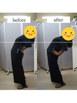 アップルミント/＜リンパ整体＞before・after