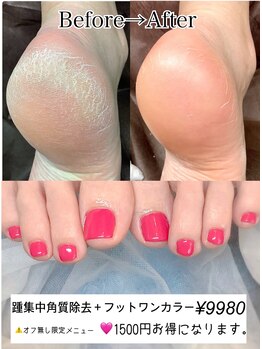 ネイルエイト 新百合ヶ丘(nail8)/お得セット割！サンダル対策♪♪